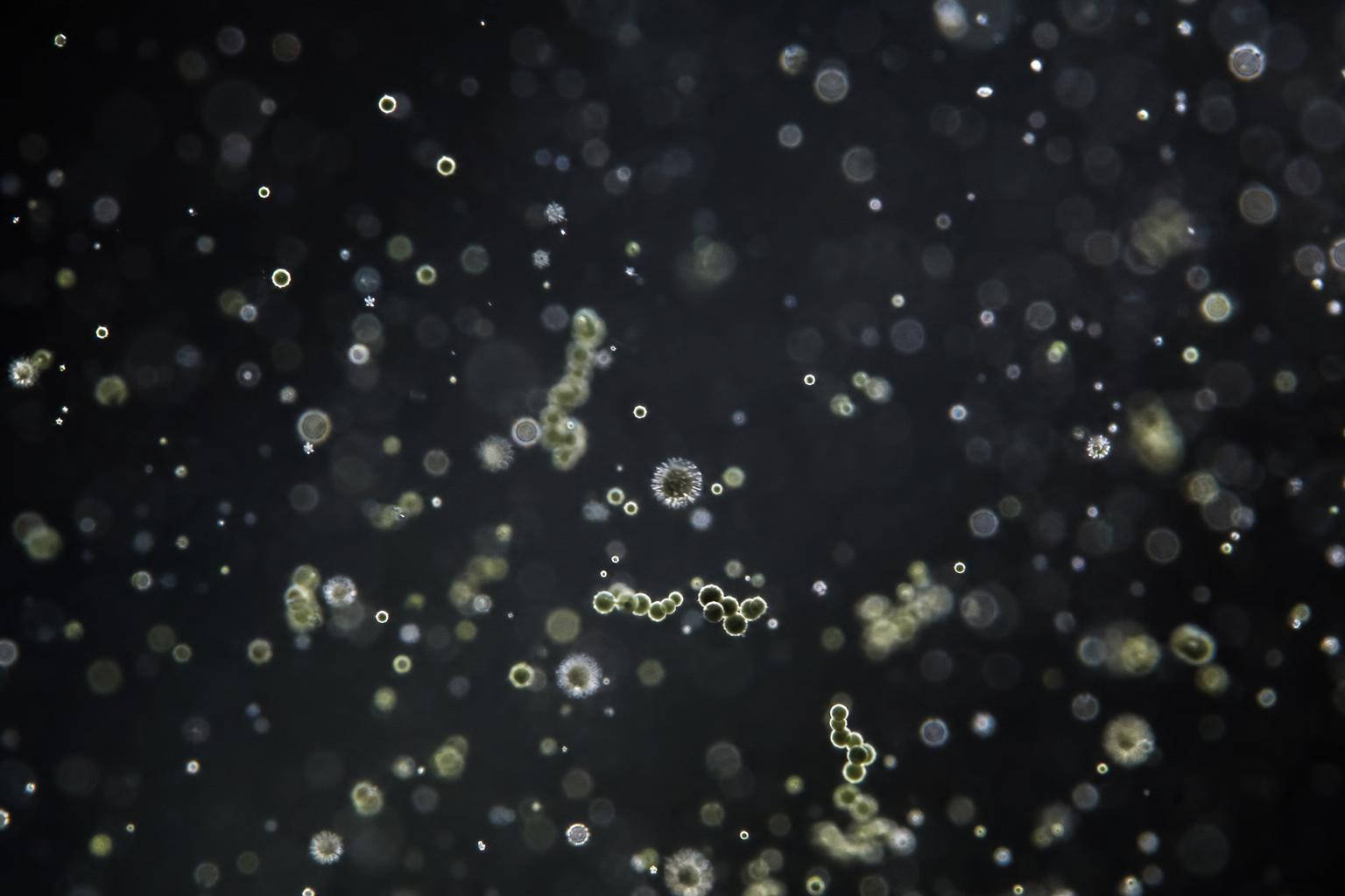 High magnification photograph of airborne dust and mould spores suspended in a shaft of light against a dark background